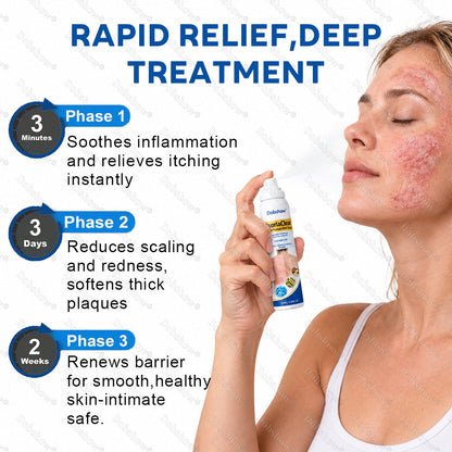 Dobshow® PsoriaClear No-Rub Psoriasis Relief Spray