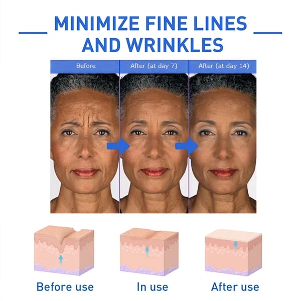 (🔥Last Day Promotion)🔥Nurbini™Luxury Botox Facial- Essence