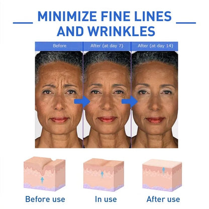 (🔥Last Day Promotion)🔥Nurbini™Luxury Botox Facial- Essence