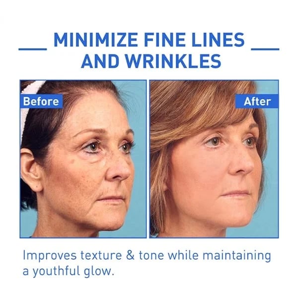 (🔥Last Day Promotion)🔥Nurbini™Luxury Botox Facial- Essence