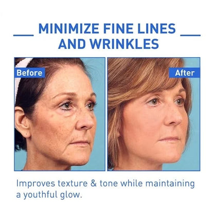 (🔥Last Day Promotion)🔥Nurbini™Luxury Botox Facial- Essence