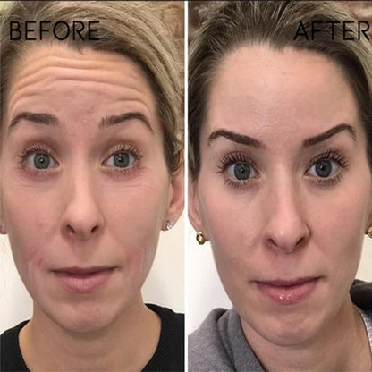 (🔥Last Day Promotion)🔥Nurbini™Luxury Botox Facial- Essence