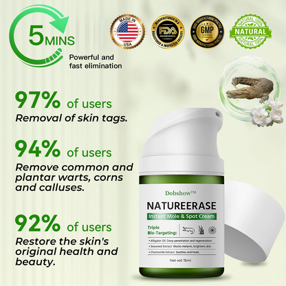 ✅ Official Store: Dobshow™ NatureErase Instant Mole & Spot Cream