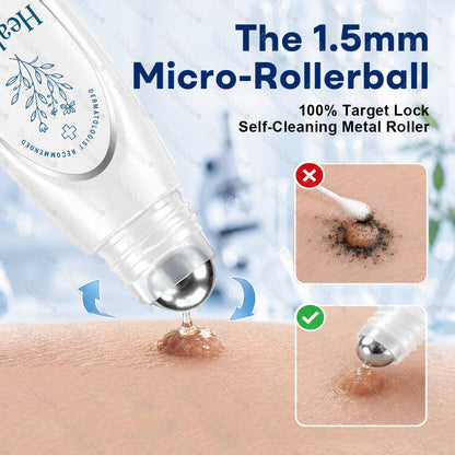 Healrize® Cryo Roll-On Wart Remover Pen