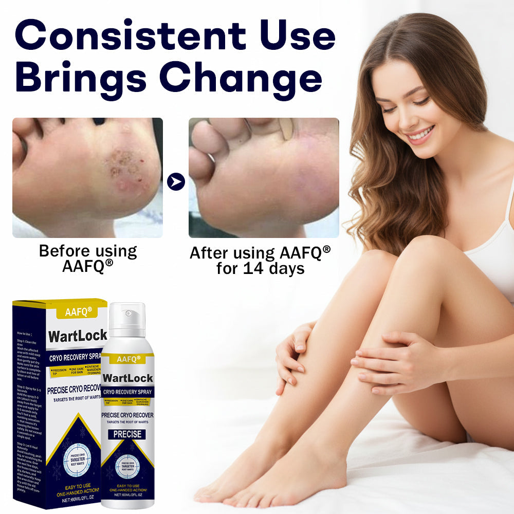 🎄𝙃𝙤𝙡𝙞𝙙𝙖𝙮 𝙎𝙖𝙡𝙚🎁AAFQ® WartLock CRYO RECOVERY SPRAY