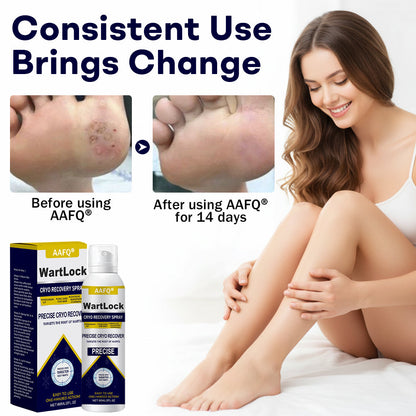 🎄𝙃𝙤𝙡𝙞𝙙𝙖𝙮 𝙎𝙖𝙡𝙚🎁AAFQ® WartLock CRYO RECOVERY SPRAY