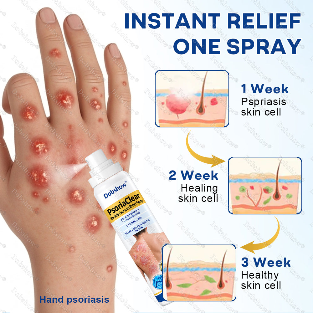 Dobshow® PsoriaClear No-Rub Psoriasis Relief Spray