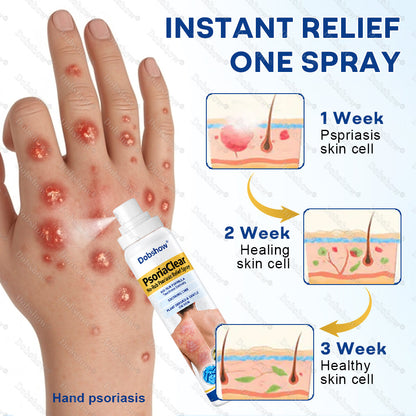 Dobshow® PsoriaClear No-Rub Psoriasis Relief Spray