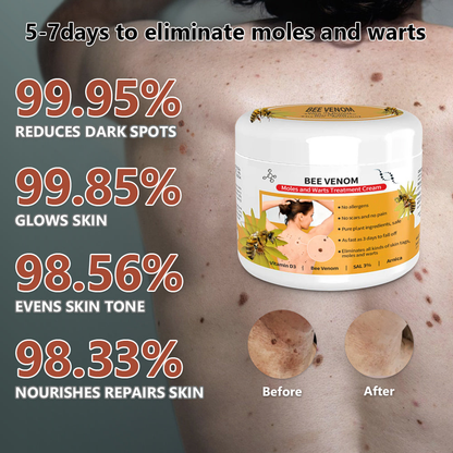 🐝🐝 Dobshow™Bee Venom Mole and Wart Treatment Cream