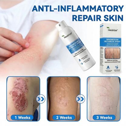 ✨Healrize® Magnesium Botanical Spray – Advanced Skin Recovery for Psoriasis & Eczema | Rapid Soothing, Steroid-Free