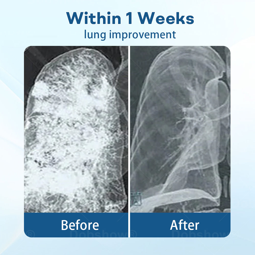 Cvreoz® DoubleNano Advanced Lung Detox Patch for Relief