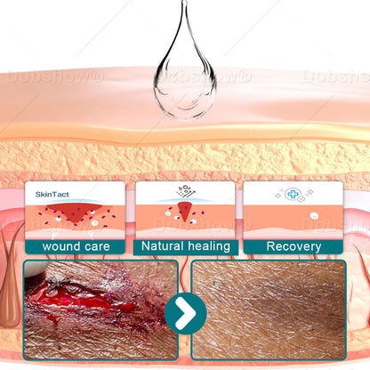 𝗖𝗿𝗼𝗮𝗶𝗲® 𝗦𝗞𝗜𝗡𝗦𝗛𝗜𝗘𝗟𝗗 𝗤𝗨𝗜𝗖𝗞𝗗𝗥𝗬𝗜𝗡𝗚 𝗟𝗜𝗤𝗨𝗜𝗗 𝗕𝗔𝗡𝗗𝗔𝗚𝗘