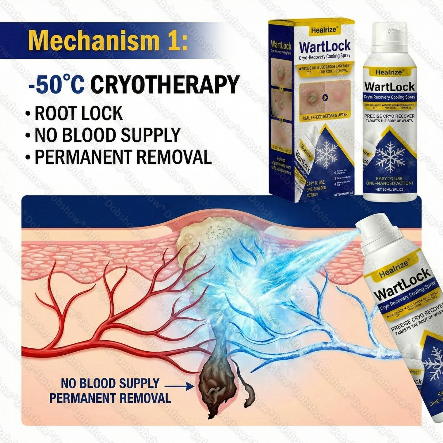 🔥𝙈𝙖𝙮 𝙎𝙥𝙚𝙘𝙞𝙖𝙡 𝙊𝙛𝙛𝙚𝙧 | Healrize® WartLock Cryo-Recovery Cooling Spray