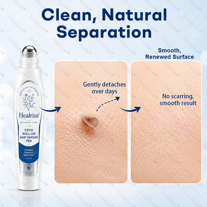 Healrize® Cryo Roll-On Wart Remover Pen