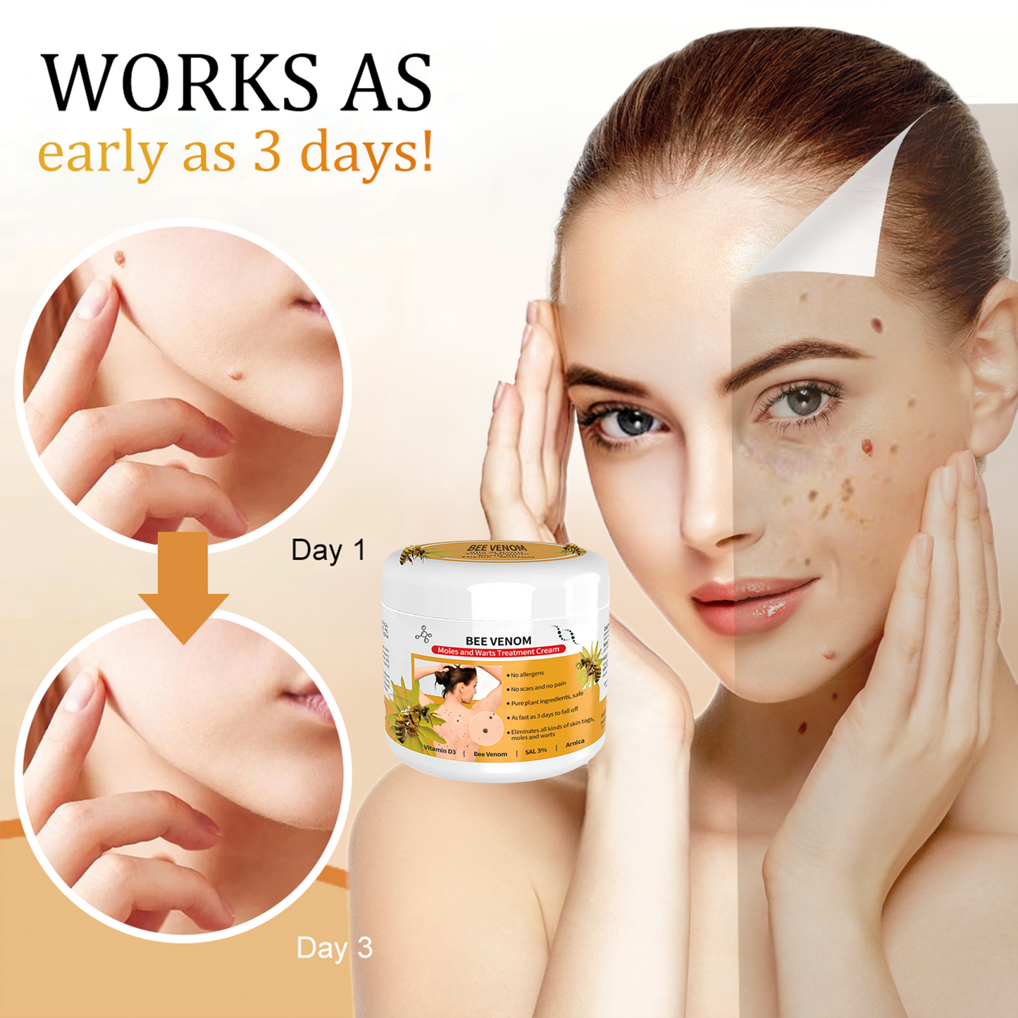 🐝🐝 Dobshow™Bee Venom Mole and Wart Treatment Cream