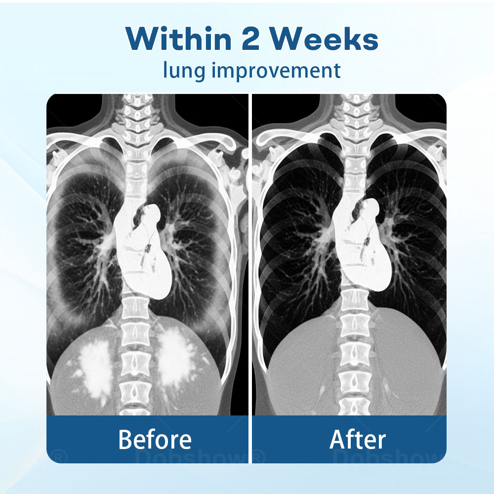 Cvreoz® DoubleNano Advanced Lung Detox Patch for Relief