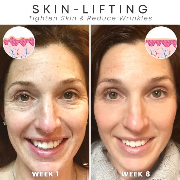 (🔥Last Day Promotion)🔥Nurbini™Luxury Botox Facial- Essence