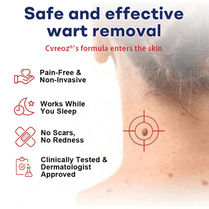 Cvreoz® Mole and Wart Removal Cream