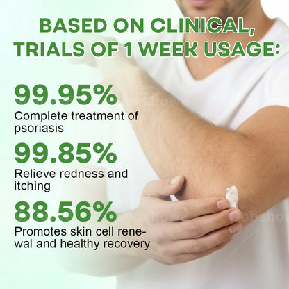 Piguiay® Herbal Psoriasis Relief Cream