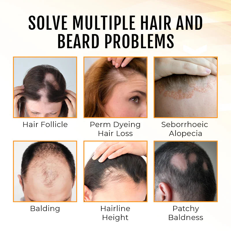 Dobshow™ PremiumLocks Biotin Hair & Beard Growth Spray💁‍♀️🧔