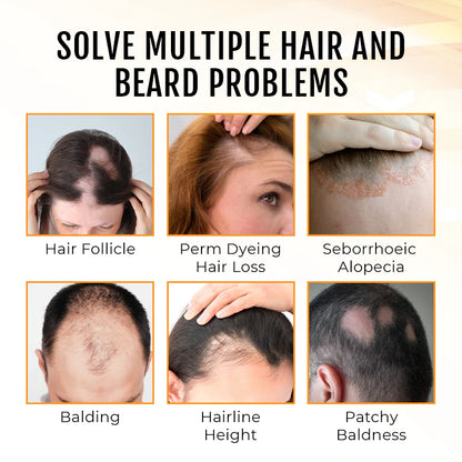 Dobshow™ PremiumLocks Biotin Hair & Beard Growth Spray💁‍♀️🧔