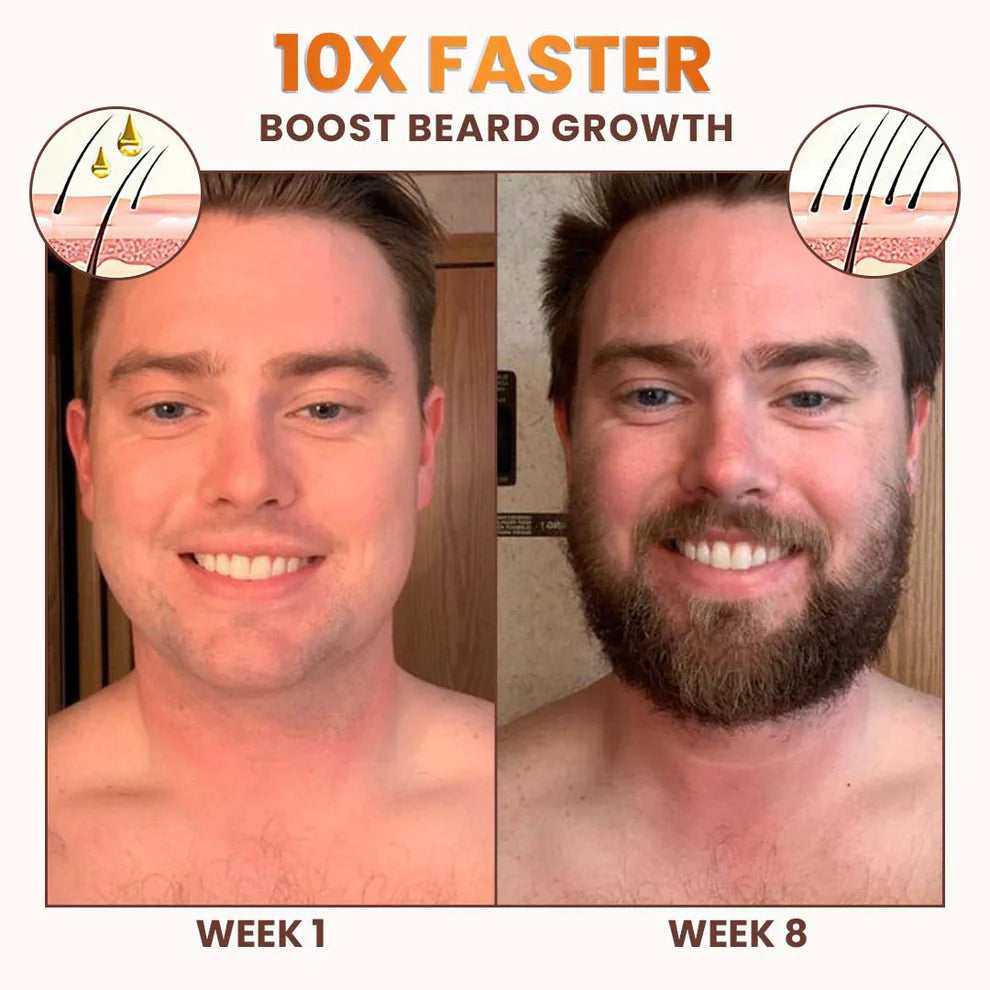 Dobshow™ PremiumLocks Biotin Hair & Beard Growth Spray💁‍♀️🧔
