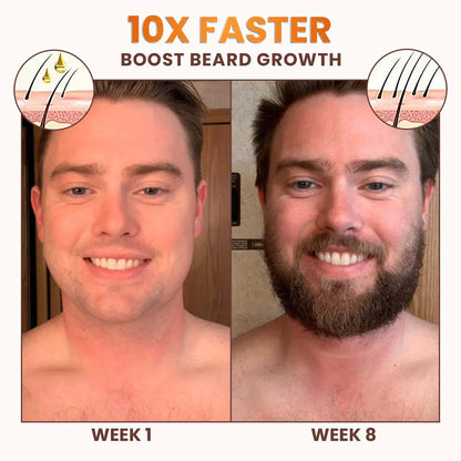 Dobshow™ PremiumLocks Biotin Hair & Beard Growth Spray💁‍♀️🧔