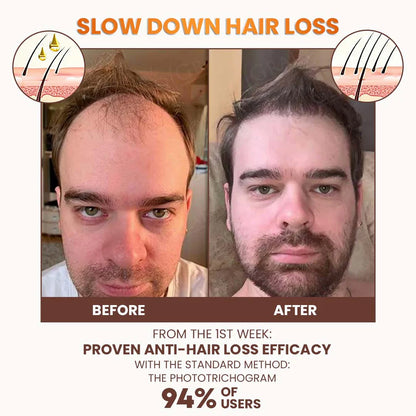 Dobshow™ PremiumLocks Biotin Hair & Beard Growth Spray💁‍♀️🧔