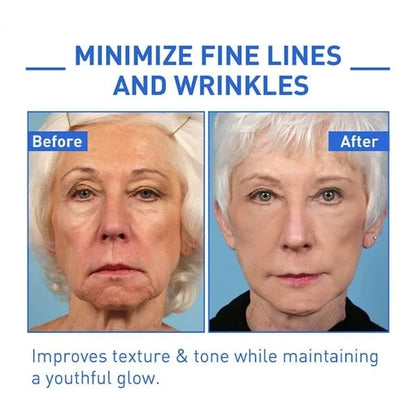 (🔥Last Day Promotion)🔥Nurbini™Luxury Botox Facial- Essence