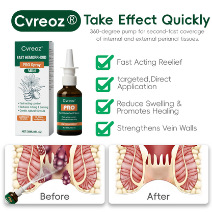 🎄𝙃𝙤𝙡𝙞𝙙𝙖𝙮 𝙎𝙖𝙡𝙚🎁 Cvreoz® Fast Hemorrhoid PRO Spray🍑